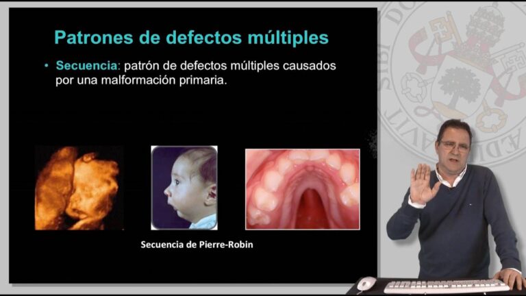Causas de deformaciones estructurales: factores clave
